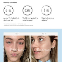 Filterbaby Skincare Filter 2.0